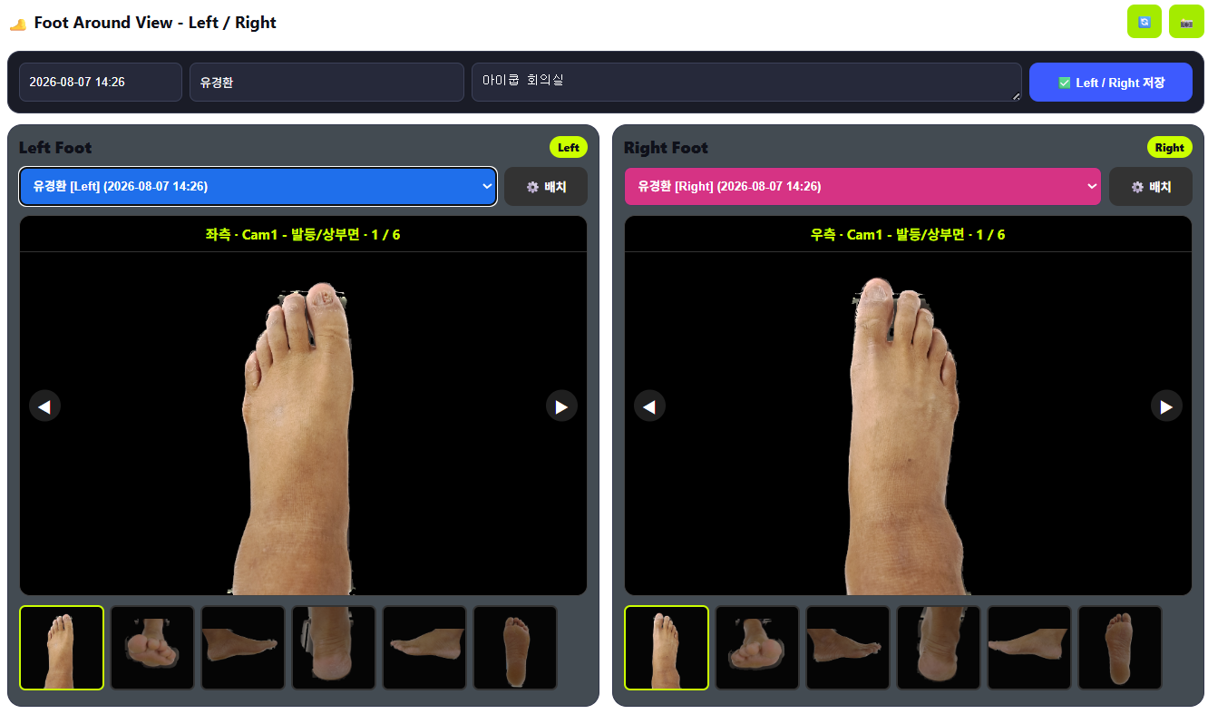 Foot View · 좌우 발 영상 뷰어